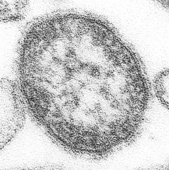 8 Questions and Answers for the Measles Outbreak NW