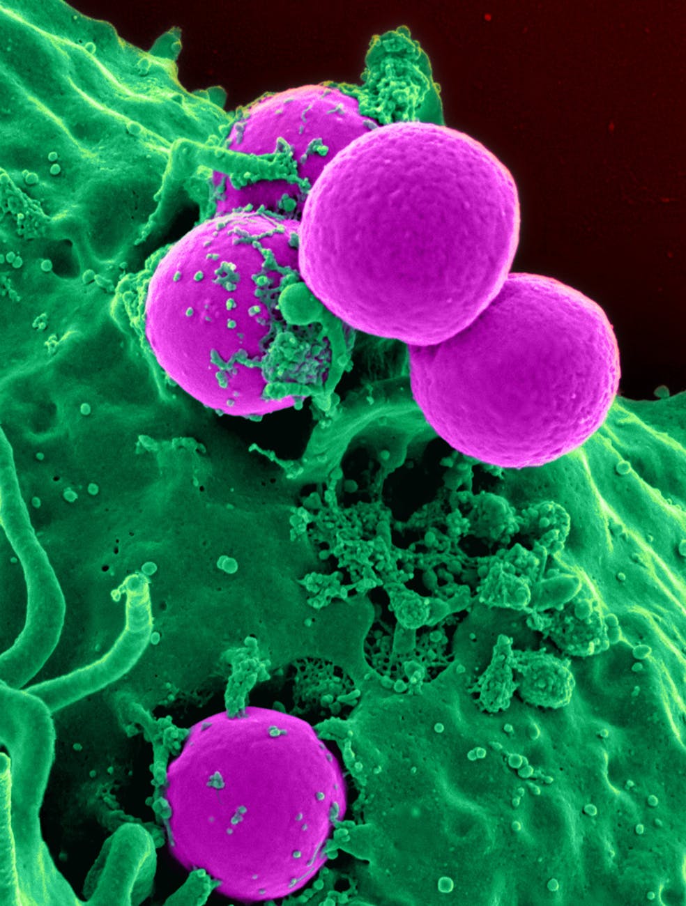 Microbes in Health and Disease