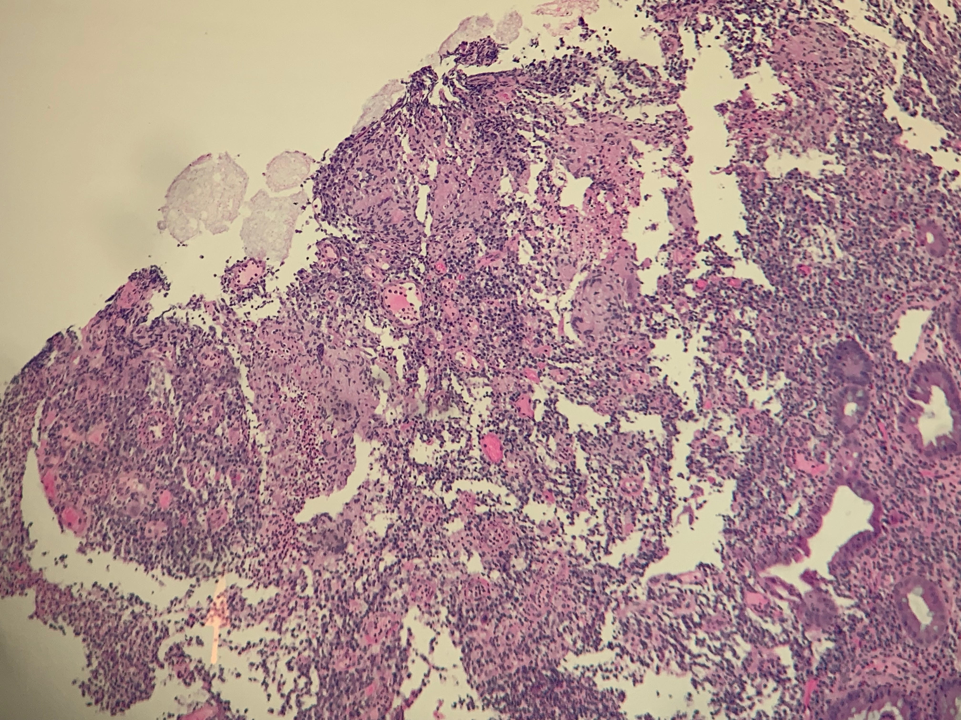 Case Report:  An Incidental Finding